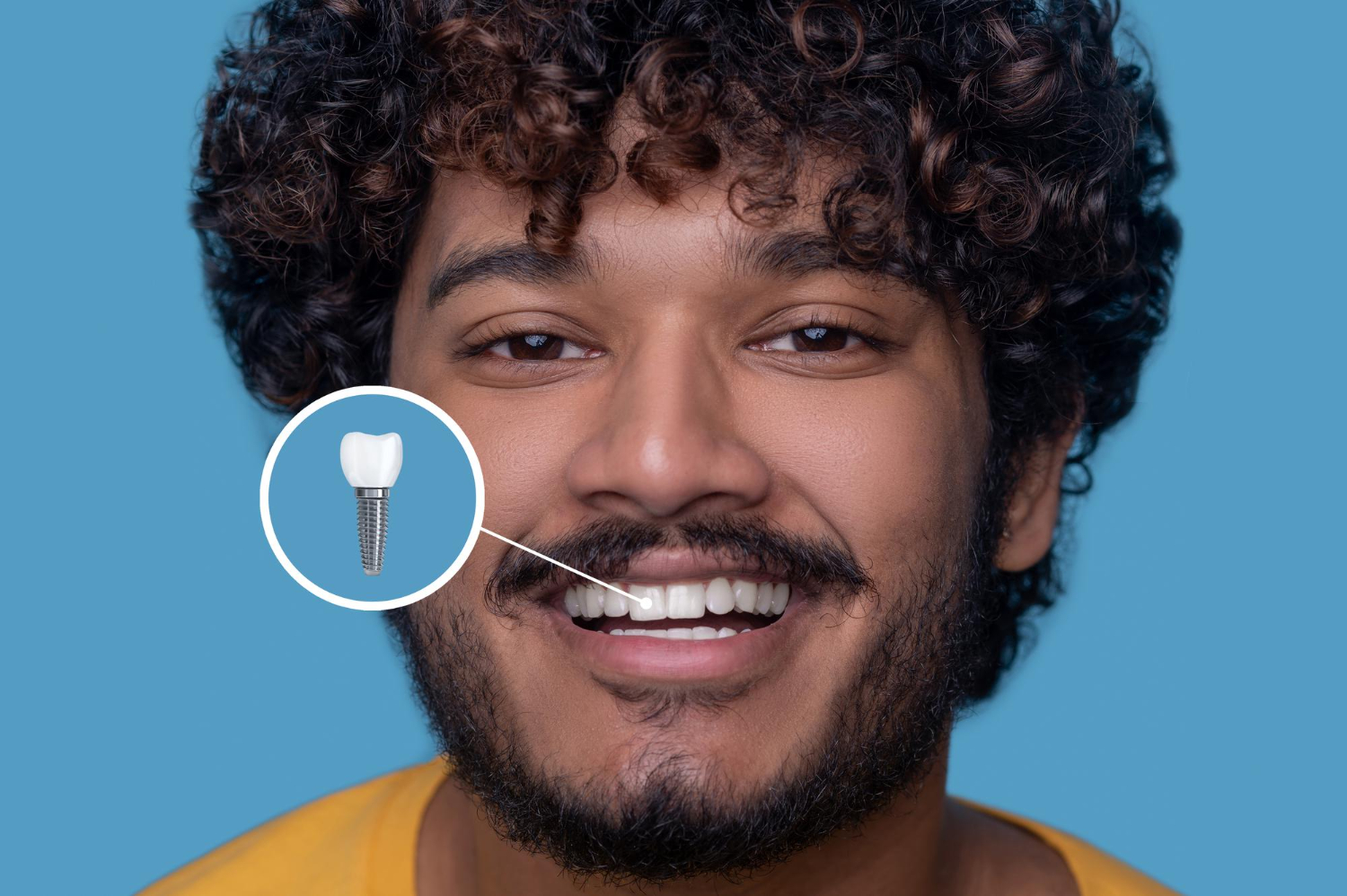 Aesthetic Cosmetic Smile Results